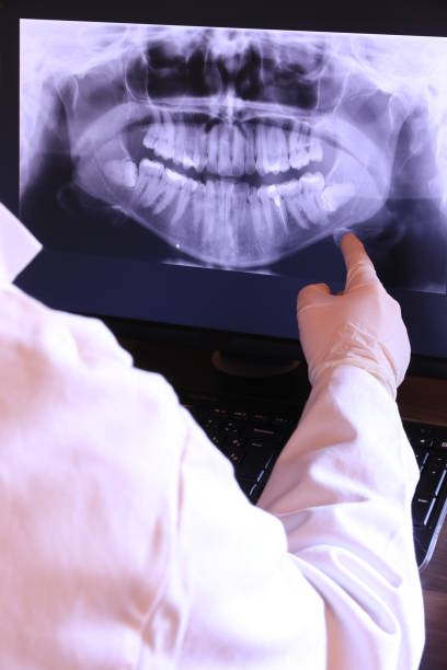 Best Emergency Dentist for Lost Fillings or Crowns in Queensland, MD